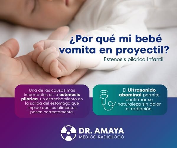 ¿𝙋𝙤𝙧 𝙦𝙪𝙚́ 𝙢𝙞 𝙗𝙚𝙗𝙚́ 𝙫𝙤𝙢𝙞𝙩𝙖 𝙚𝙣 𝙥𝙧𝙤𝙮𝙚𝙘𝙩𝙞𝙡?