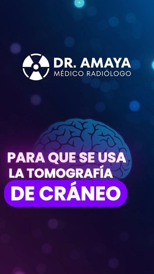 ¿Para qué sirve una tomografía de cráneo?