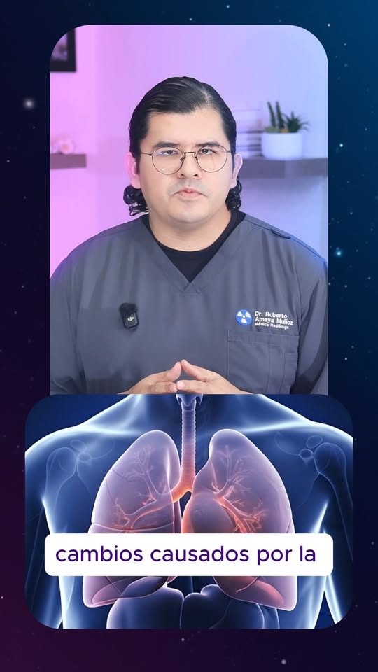 ¿Para qué sirve la tomografía de tórax?