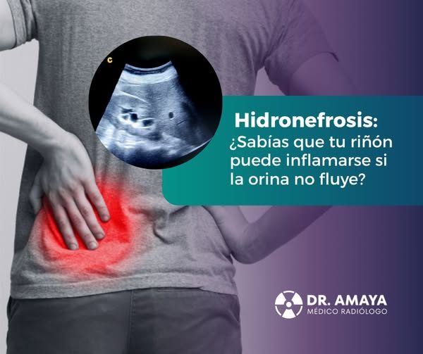 ¿𝙎𝙖𝙗𝙞́𝙖𝙨 𝙦𝙪𝙚 𝙩𝙪 𝙧𝙞𝙣̃𝙤́𝙣 𝙥𝙪𝙚𝙙𝙚 𝙞𝙣𝙛𝙡𝙖𝙢𝙖𝙧𝙨𝙚 𝙨𝙞…