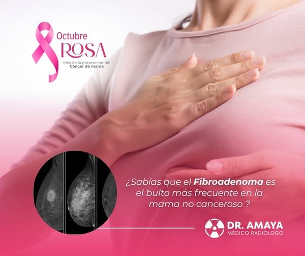 ¿𝙎𝙖𝙗𝙞́𝙖𝙨 𝙦𝙪𝙚 𝙚𝙡 𝙗𝙪𝙡𝙩𝙤 𝙢𝙖́𝙨 𝙛𝙧𝙚𝙘𝙪𝙚𝙣𝙩𝙚 𝙚𝙣 𝙡𝙖 𝙢…