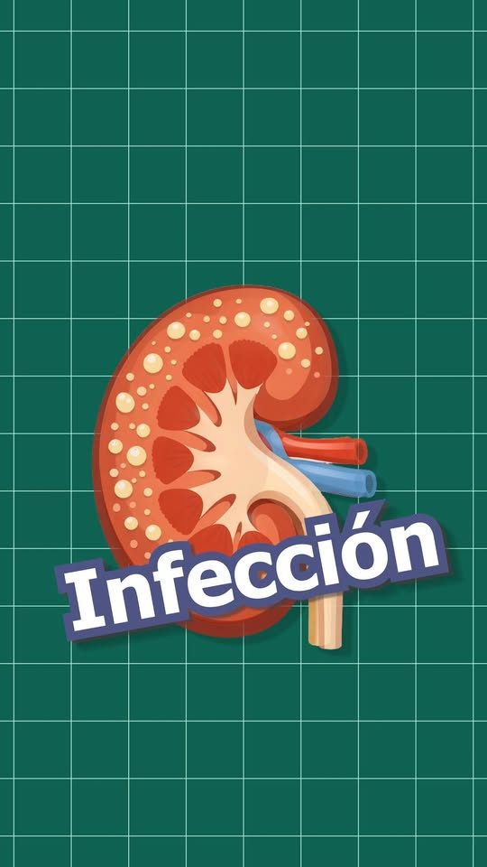 ¿Dolor fuerte en un solo costado y fiebre alta?