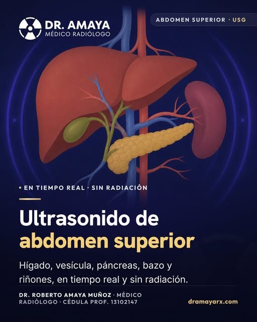 ¿Qué se ve en un ultrasonido de abdomen superior?